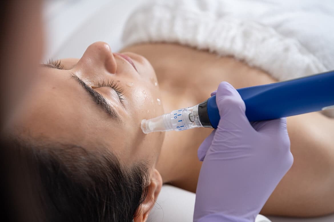June Academy Microneedling training course